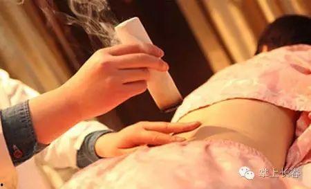 成人脐疝艾灸视频,艾灸疗法助您缓解成人脐疝不适