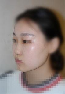 成人礼整鼻子视频大全,鼻子整形视频大全解析