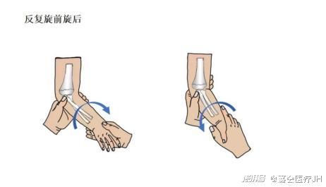 成人前臂脱臼复位法视频